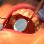 Dental Care Cost